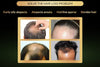 Image of Hair Growth Spray Essential Oil